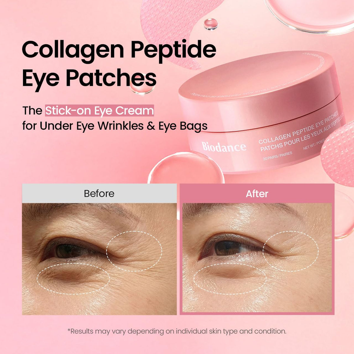 BIODANCE Hydrogel Eye Patches for Under Eye - Caviar PDRN, Depuffing & Eye Bags (60 Count)